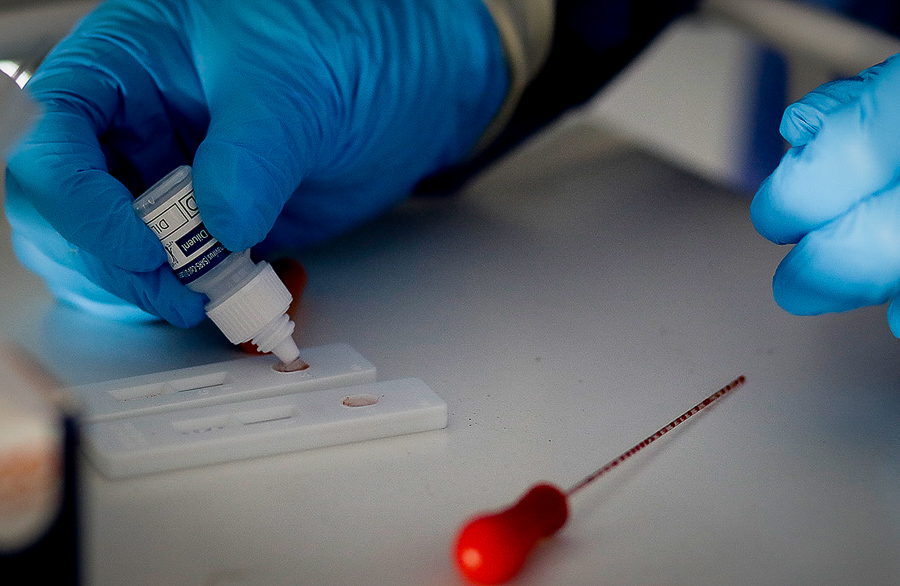 variante da ômicron - covid-19 - coronavírus