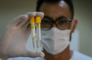 Pesquisa brasileira identificou que Covid "ataca" o cérebro de forma semelhante à esquizofrenia