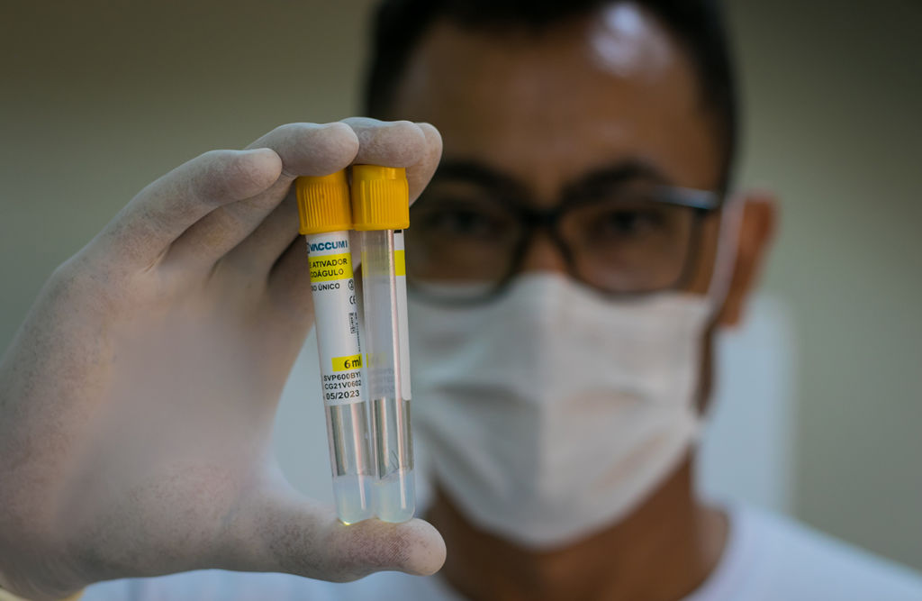 Pesquisa brasileira identificou que Covid "ataca" o cérebro de forma semelhante à esquizofrenia