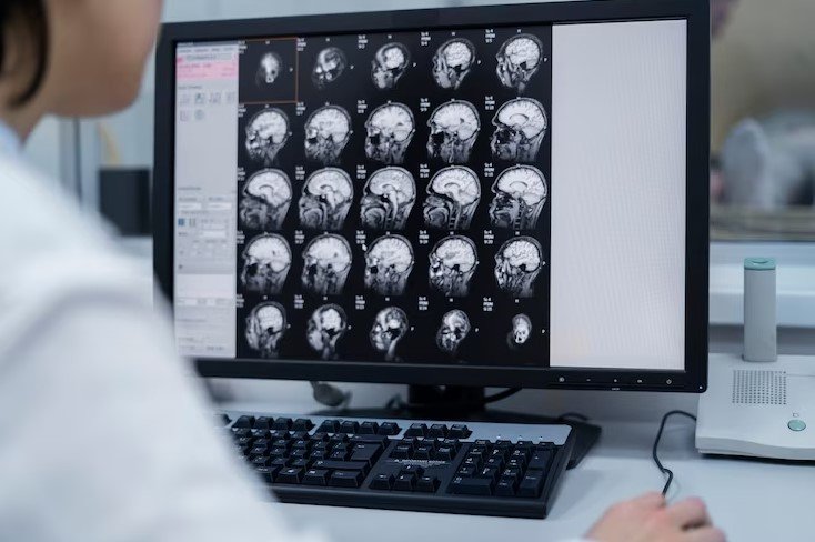 Radiologia / radiação